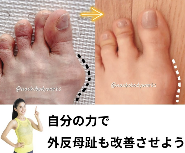 Ｏ脚矯正ボディメイク講座（下半身）